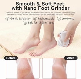 Electric Callus Remover for Feet - Rechargeable Cat Paw Foot File with 3 Roller Heads,Digital Display, 3 Speeds & Mood Light - Gentle Pedicure for Dead Skin, Calluses, Dry Heels