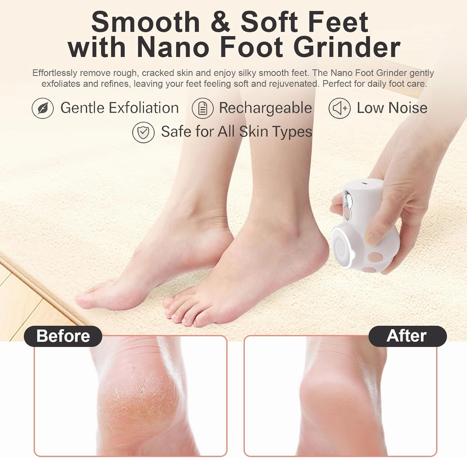 Electric Callus Remover for Feet - Rechargeable Cat Paw Foot File with 3 Roller Heads,Digital Display, 3 Speeds & Mood Light - Gentle Pedicure for Dead Skin, Calluses, Dry Heels